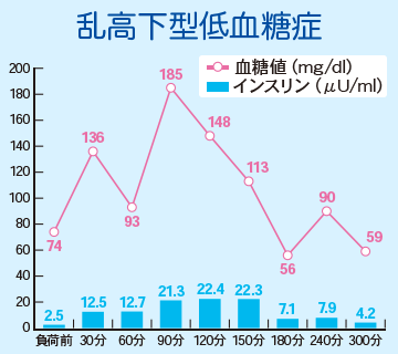 乱高下型低血糖症