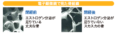 電子顕微鏡で見た閉経前後の骨組織